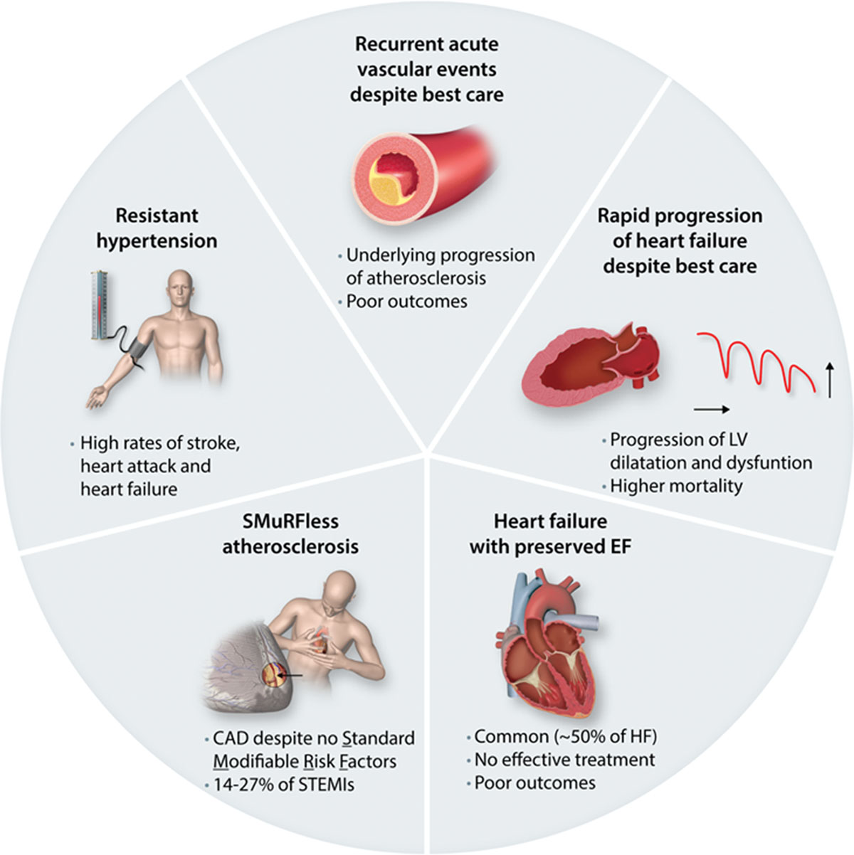 An illustration of advances in cardiovascular care.
